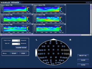meg-imageanalysis_x
